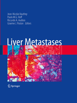 cover image of Liver Metastases